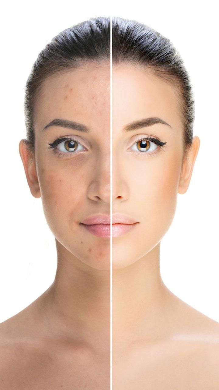 تفتيح وتوريد المناطق الحساسة